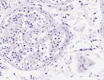 CD3D isoform A Antibody
