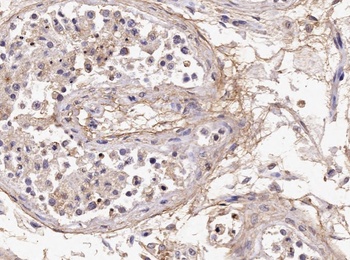 CD3E Antibody