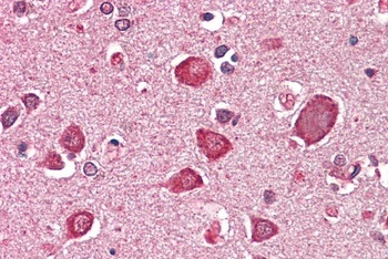 FURIN / PCSK3 Antibody