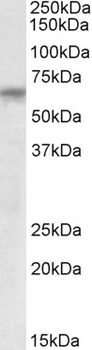 ANTXR2 / CMG2 Antibody