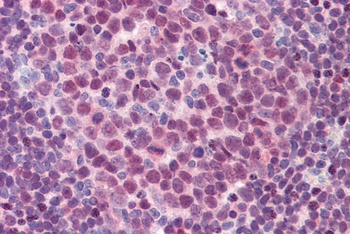 SPI1 Antibody