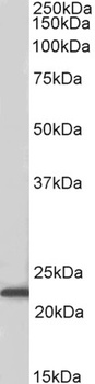 RUFY1 Antibody