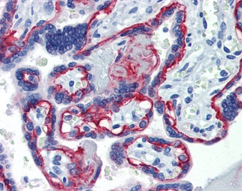 ITGB4 Antibody [439-9B]