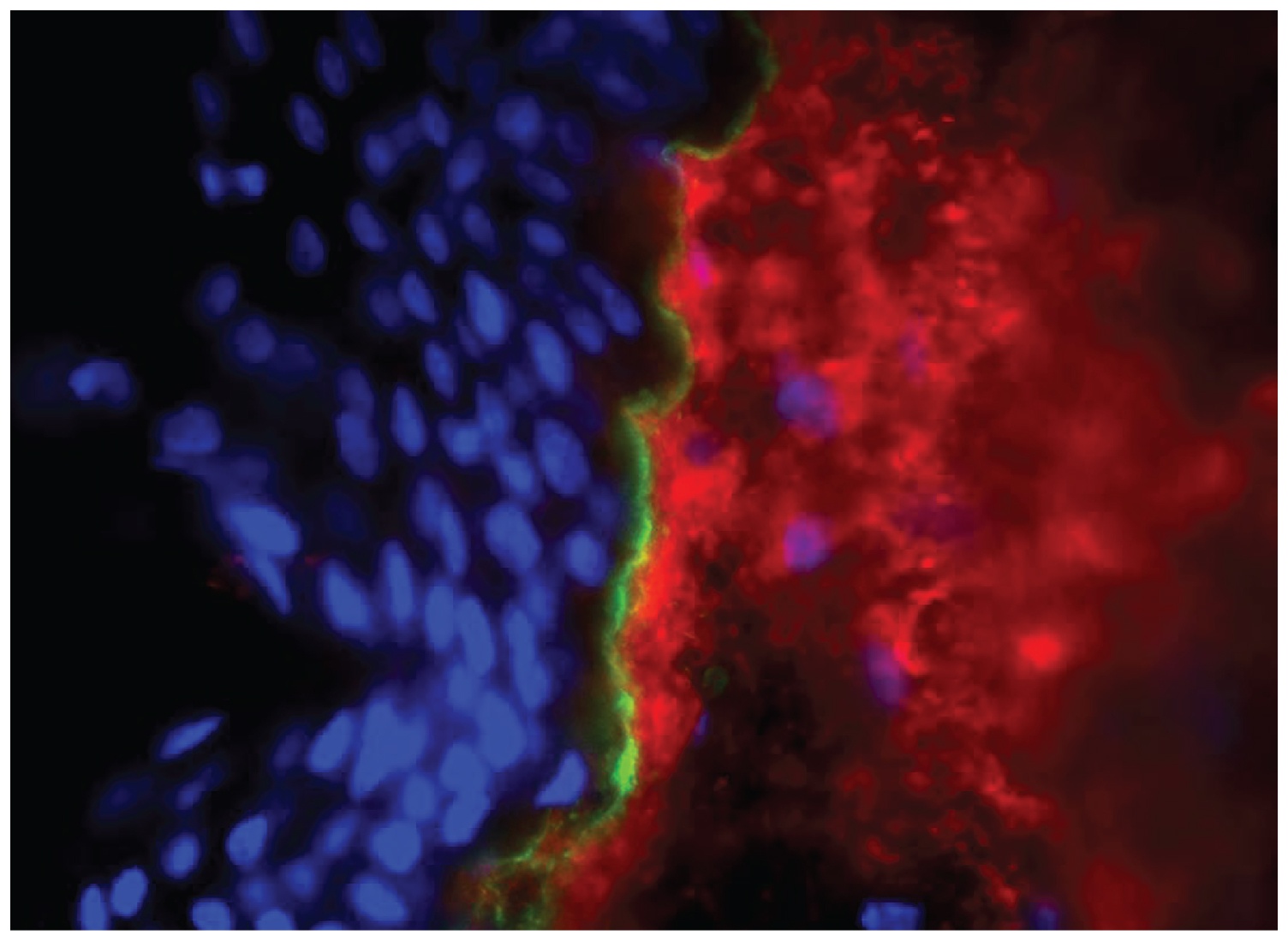 Type I Collagen Antibody [4F6]
