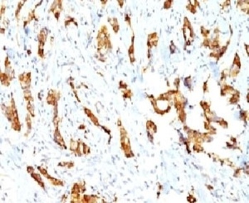 HSP27 Antibody [SPM252]
