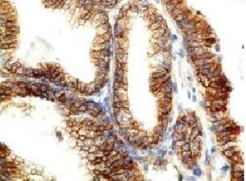 E-Cadherin Antibody [CDH1/1525]