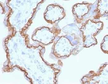 E-Cadherin Antibody [CDH1/1525]