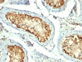 HSP60 Antibody [GROEL/730]