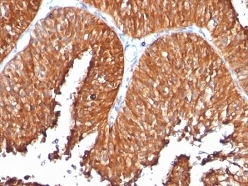 HSP60 Antibody [SPM253]