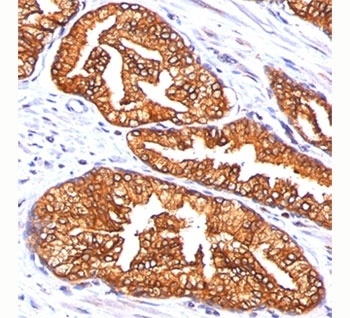 ODC-1 Antibody [ODC1/485]