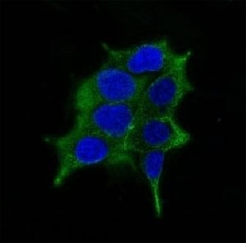 ODC-1 Antibody [ODC1/485]