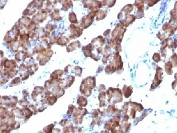 ODC-1 Antibody [ODC1/485]