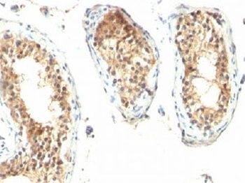 ODC-1 Antibody [ODC1/485]