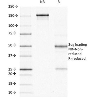 ODC-1 Antibody [ODC1/485]