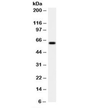 HSP60 Antibody [LK2]
