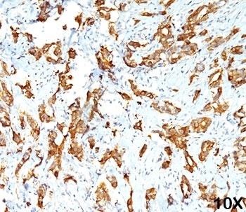 HSP27 Antibody [G3.1]