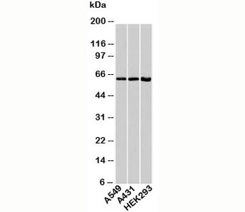 HSP60 Antibody