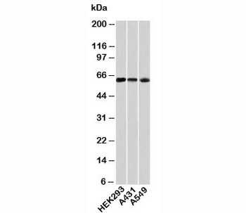 HSP60 Antibody