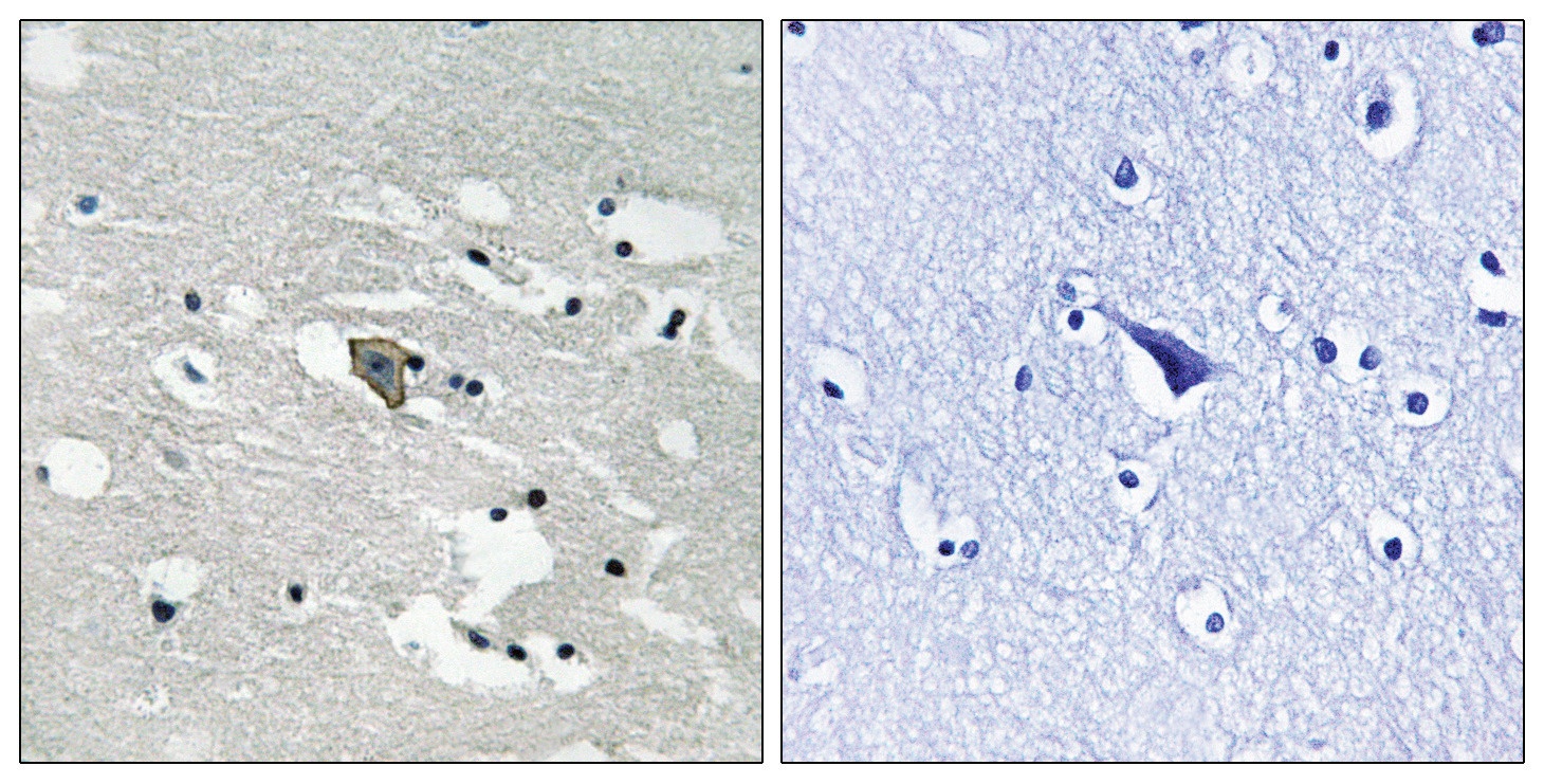 VEGFR1 (phospho Tyr1048) Antibody