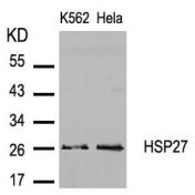 HSP27 (Ab 82) Antibody