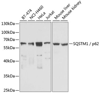 SQSTM1 / p62 Antibody