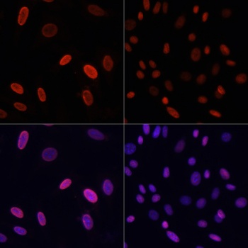 Acetyl-Histone H3-K18 pAb