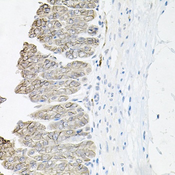 ATP1B1 Antibody