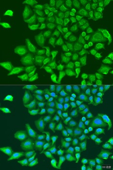 TUBGCP3 Antibody