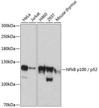 NFkB p100 / p52 Antibody