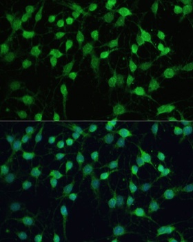 SMAD2 Antibody