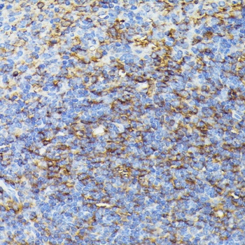 GFAP Antibody