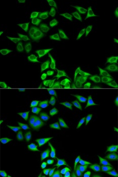CHMP2B Antibody