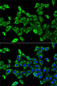 HADHA Antibody
