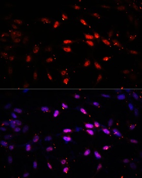 Kdm6b Antibody