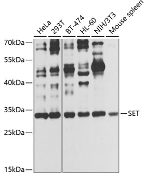 SET Antibody
