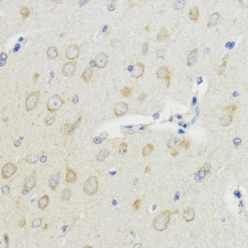 IGF1 Antibody