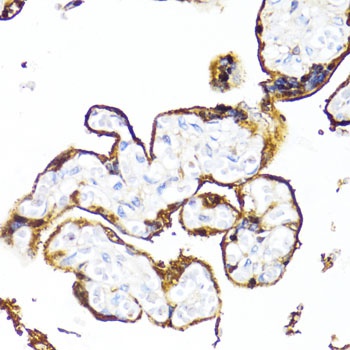 HSD17B1 Antibody