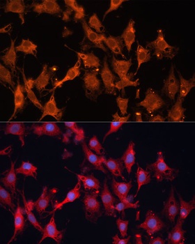 HSD17B1 Antibody