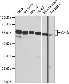 CALR Antibody