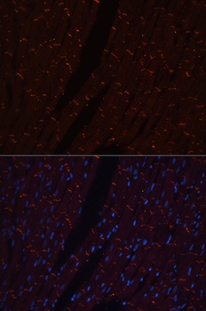 N Cadherin Antibody