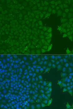 CD31 Antibody