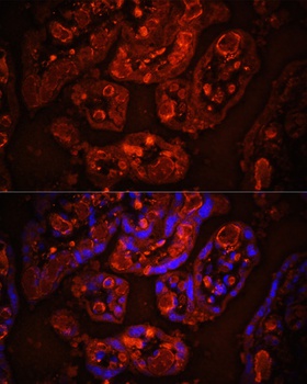 CD31 Antibody