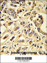 VGFR1 Antibody
