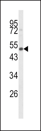 CYP24A1 Antibody