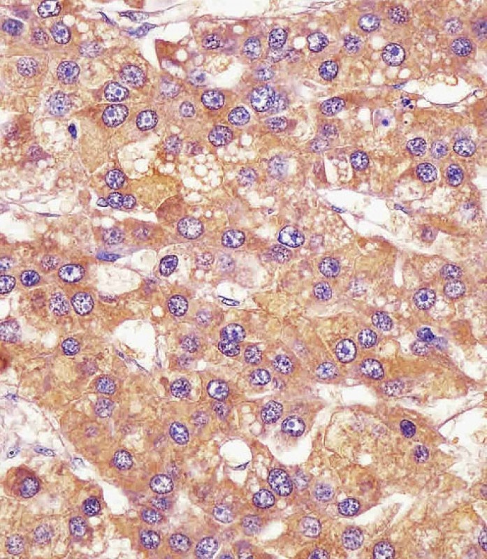 MICA Antibody