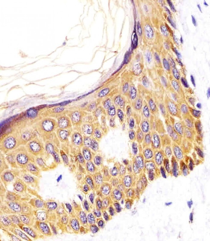 MICA Antibody