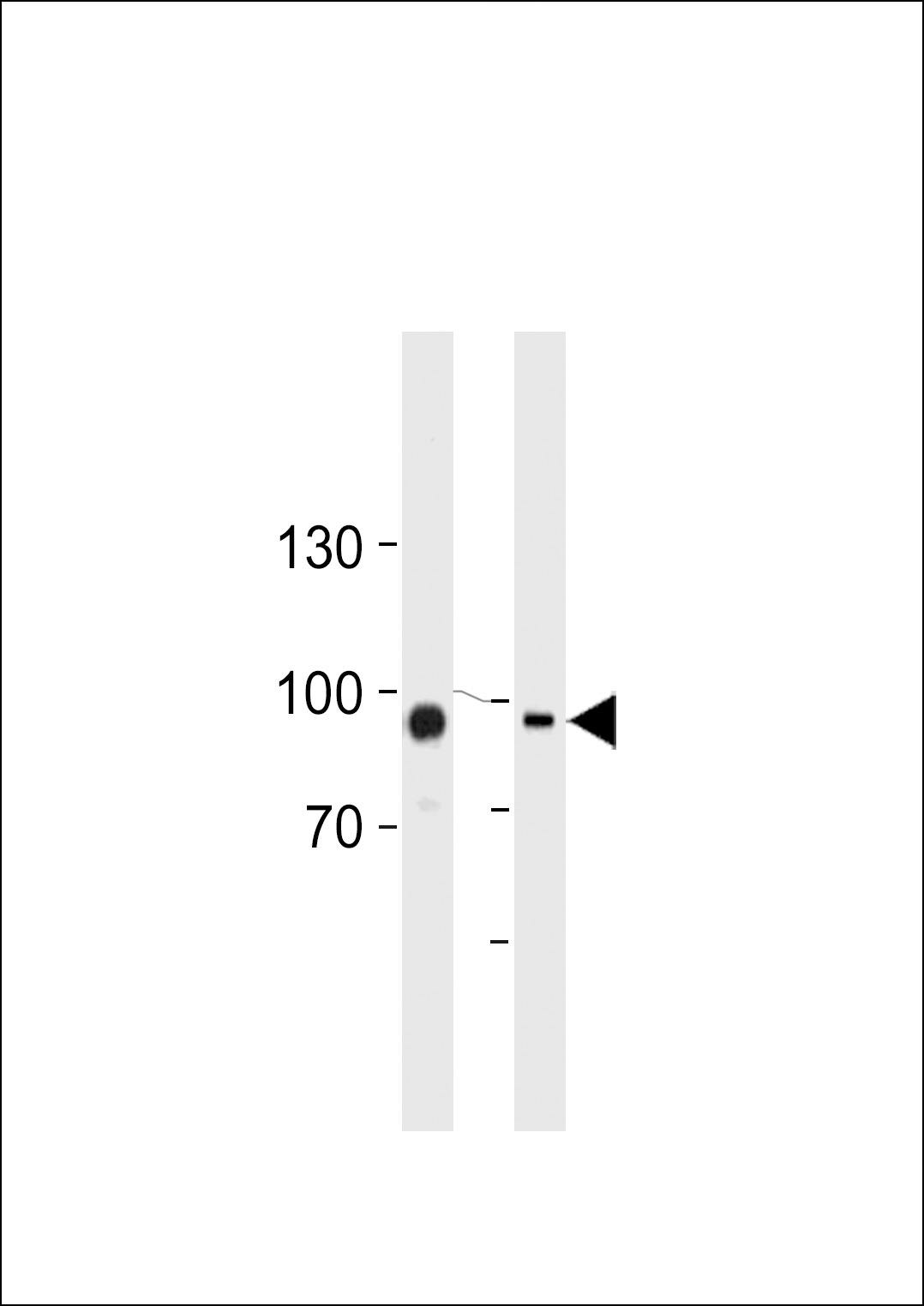 Transglutaminase Antibody