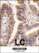 Transglutaminase Antibody
