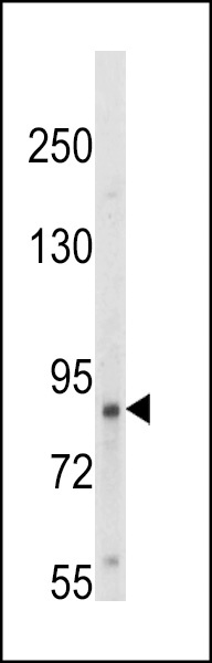TrkA-pY791 Antibody