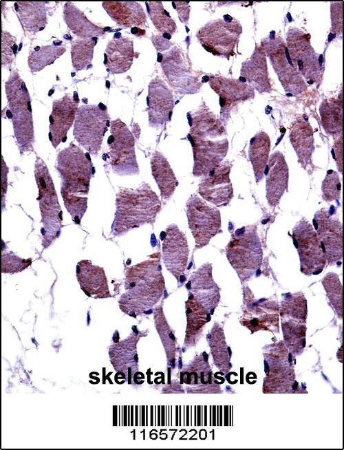 TrkA-pY791 Antibody